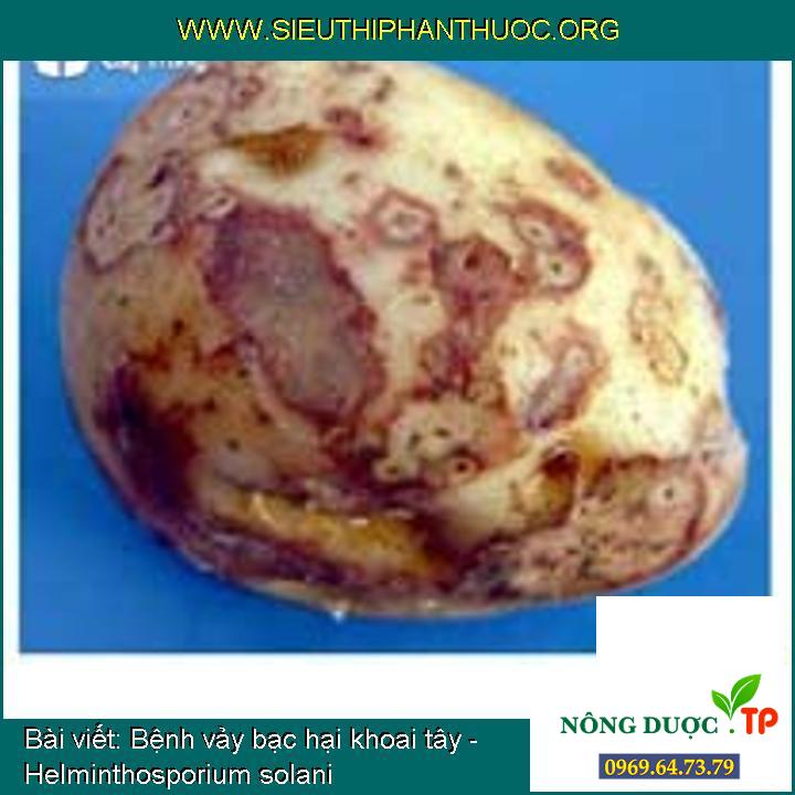Bệnh vảy bạc hại khoai tây - Helminthosporium solani