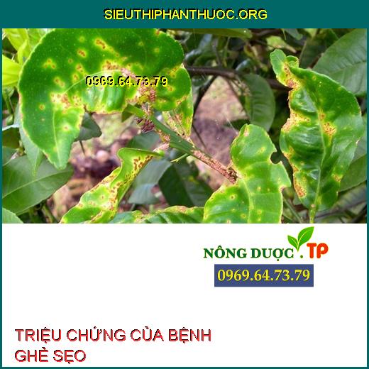 TRIỆU CHỨNG CỦA BỆNH GHẺ SẸO