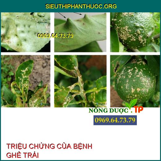 BỆNH GHẺ TRÁI