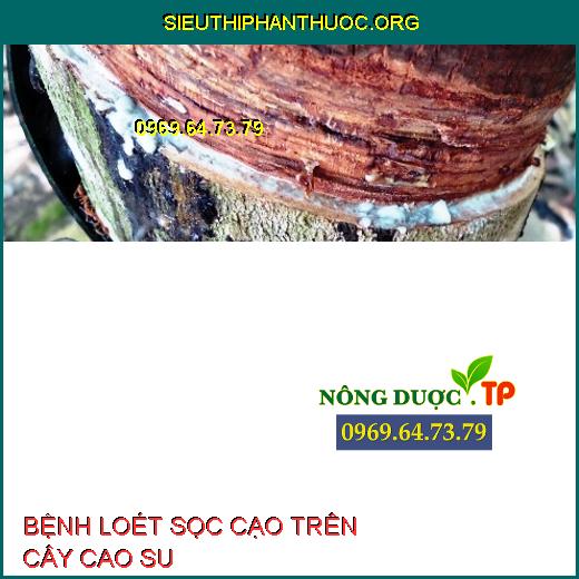 BỆNH LOÉT SỌC