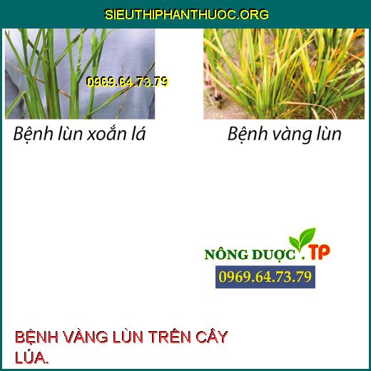 BỆNH VÀNG LÙN