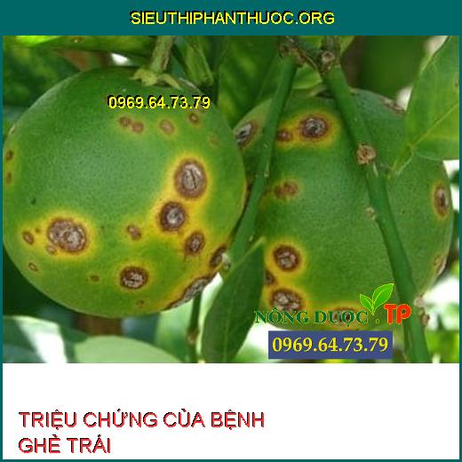 TRIỆU CHỨNG CỦA BỆNH GHẺ TRÁI