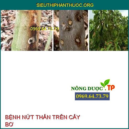 BỆNH NỨT THÂN