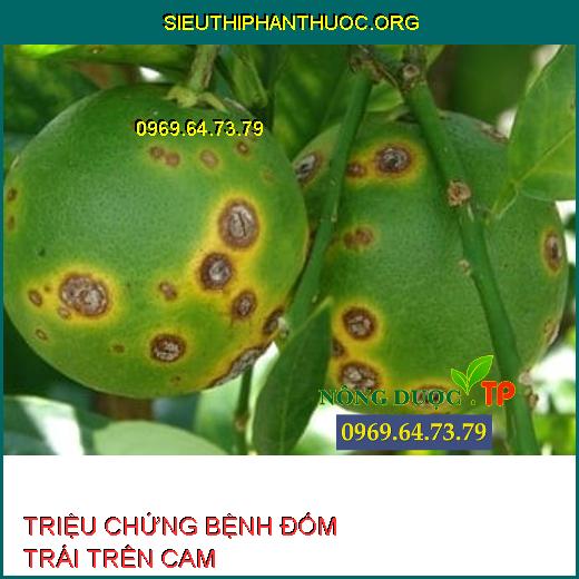 BỆNH ĐỐM TRÁI