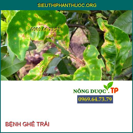 BỆNH GHẺ TRÁI