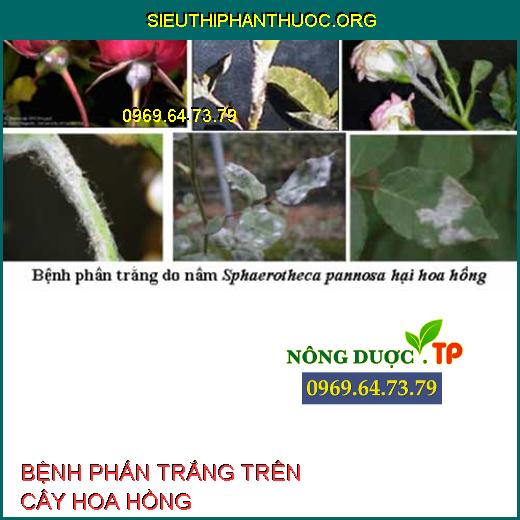 BỆNH PHẤN TRẮNG