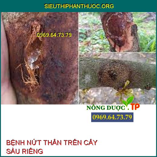 BỆNH NỨT THÂN