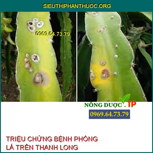 BỆNH PHỒNG LÁ