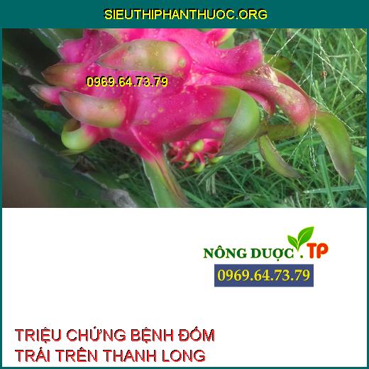 BỆNH ĐỐM TRÁI