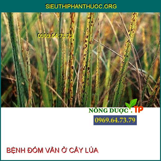 BỆNH ĐỐM VẰN