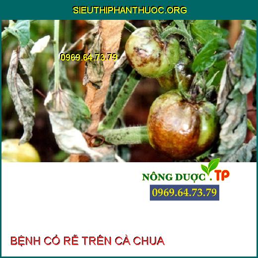 BỆNH CỔ RỄ