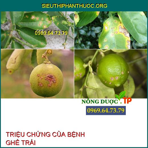  BỆNH GHẺ TRÁI 