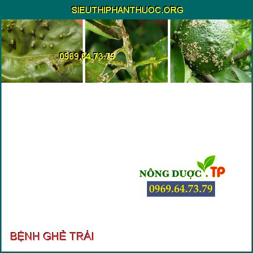 BỆNH GHẺ TRÁI