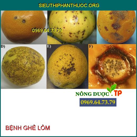 BỆNH GHẺ SẸO