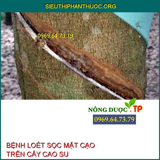 BỆNH LOÉT SỌC MẶT CẠO