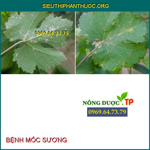 BỆNH MỐC SƯƠNG