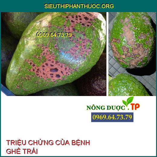 BỆNH GHẺ TRÁI