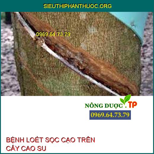 BỆNH LOÉT SỌC