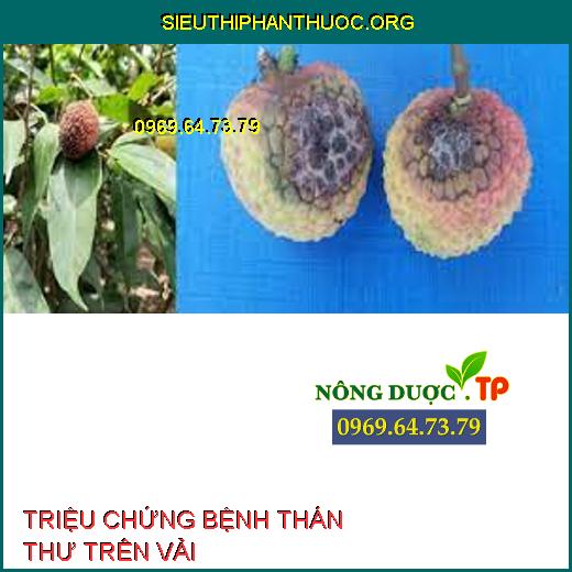 BỆNH THÁN THƯ