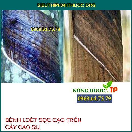 BỆNH LOÉT SỌC