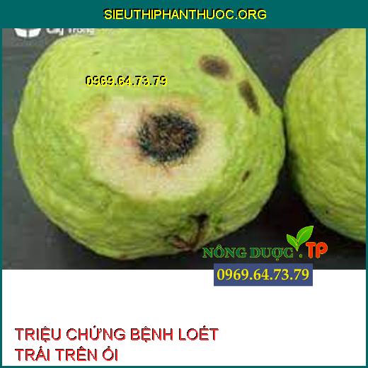 BỆNH LOÉT TRÁI