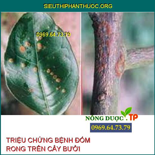 BỆNH ĐỐM RONG