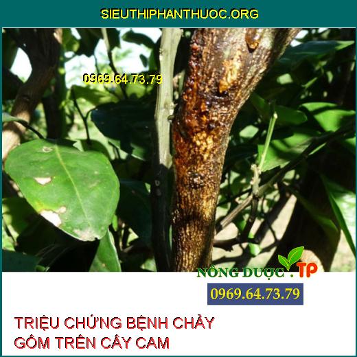 BỆNH CHẢY GÔM