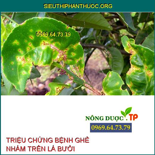 BỆNH GHẺ NHÁM