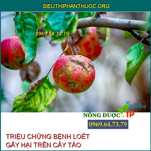 BỆNH LOÉT